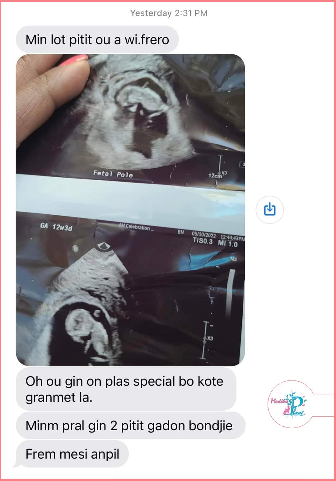 Temwayaj yon manm Hoïs sou WhatsApp