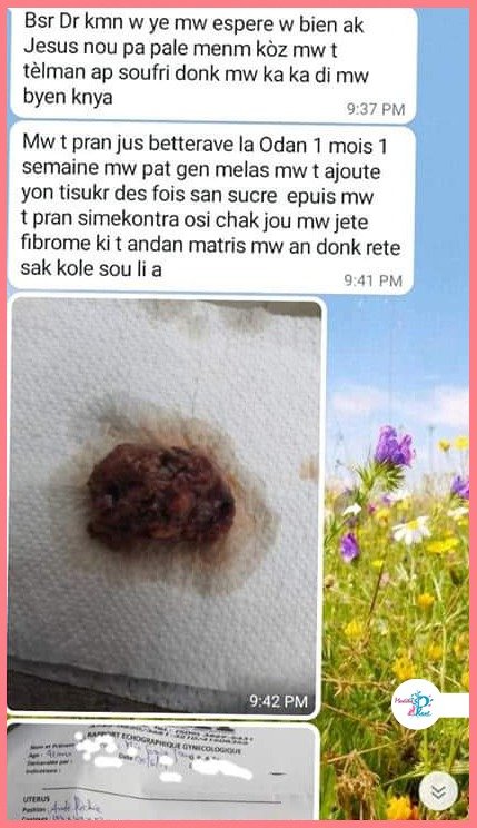 Temwayaj yon manm Hoïs sou WhatsApp